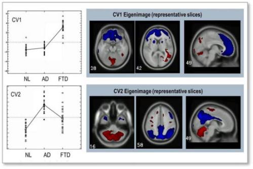 Fingerprints in the Brain